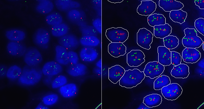 Accurate Evaluation of HER-2 Amplification in FISH Images